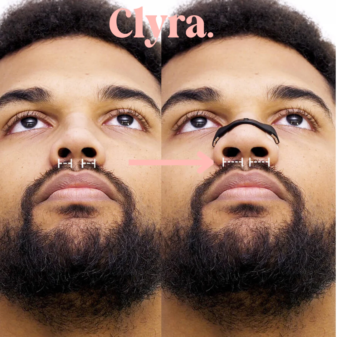 Copy_of_Copy_of_Copy_of_Nasal_Strips_4