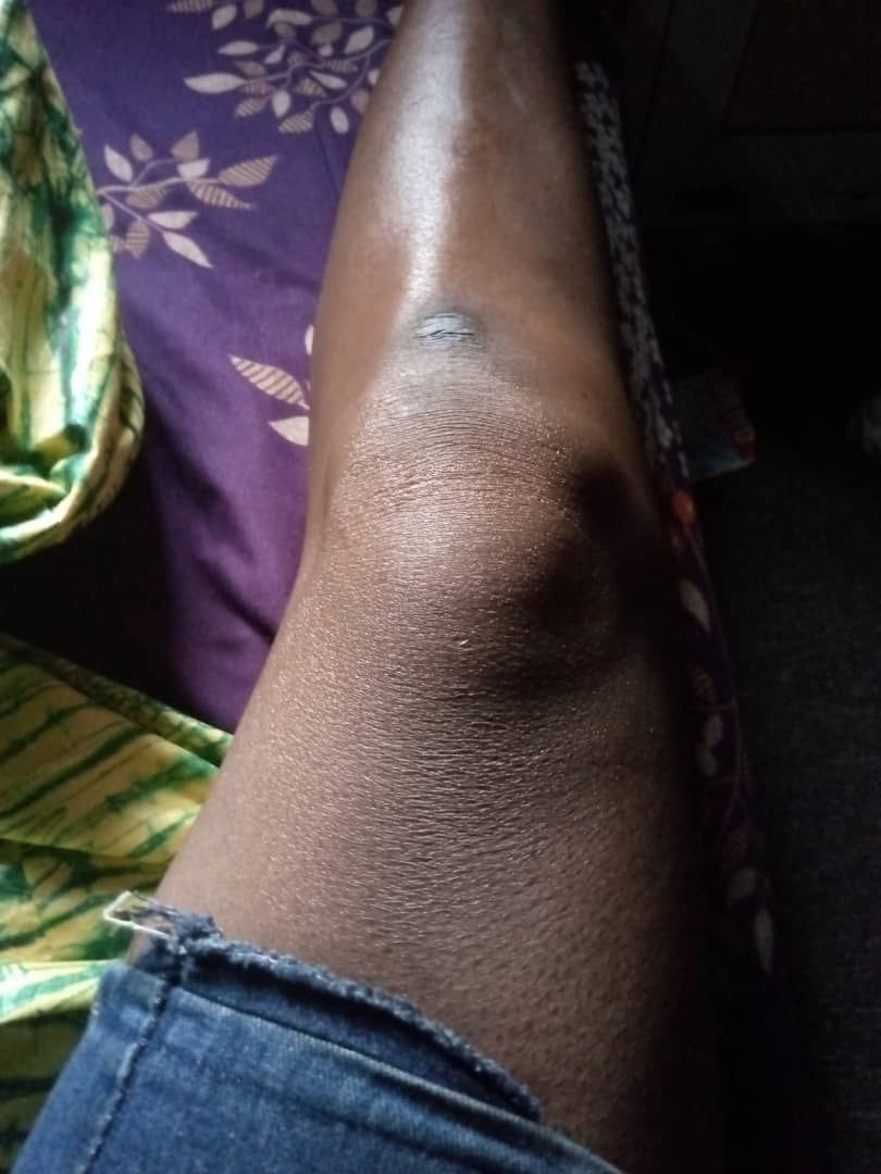 another-leg.jpg